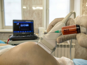 SVF-терапия: инновационная процедура для лечения суставов