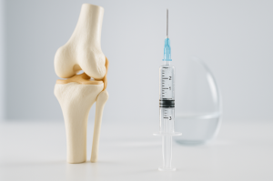Что нужно знать о внутрисуставных инъекциях с гиалуроновой кислотой